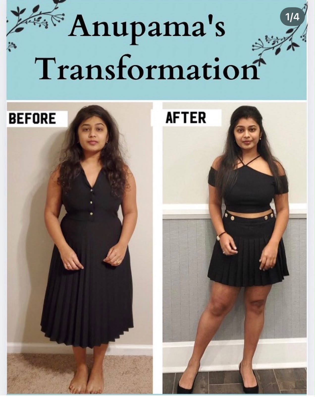 Anupama before and after